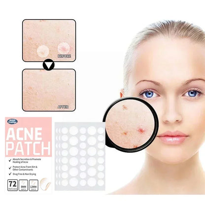 Anti-Acne Hydrocolloid Patches